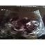 mama_brandon